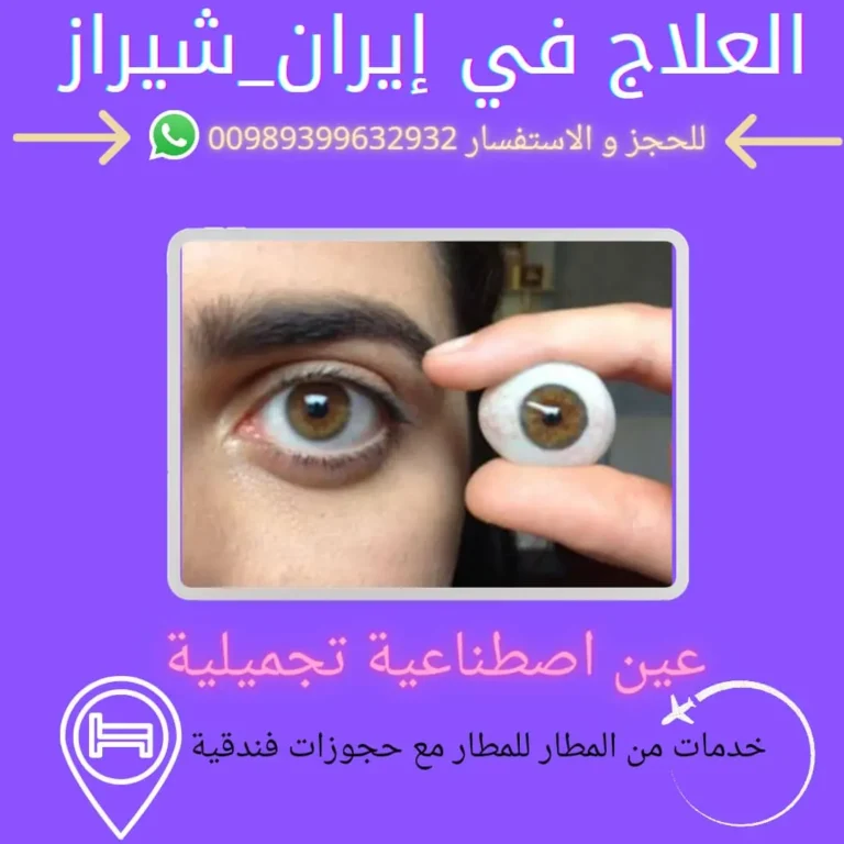 العين الصناعية في ايران