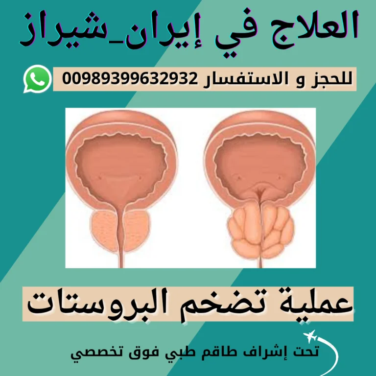 عملية البروستات في ايران