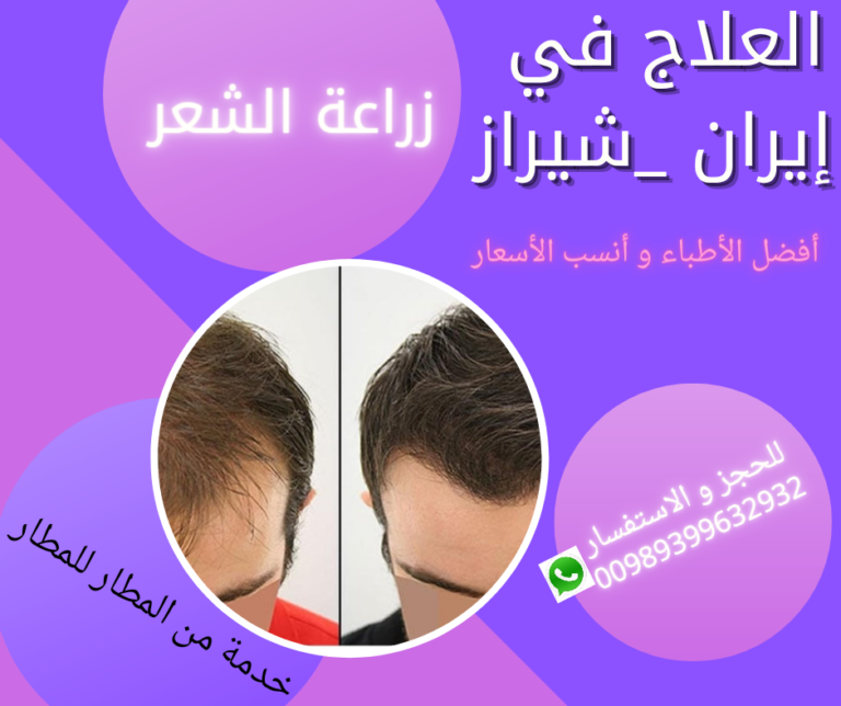 افضل مركز زراعة الشعر في ايران