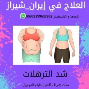 عملية شفط الدهون في ايران