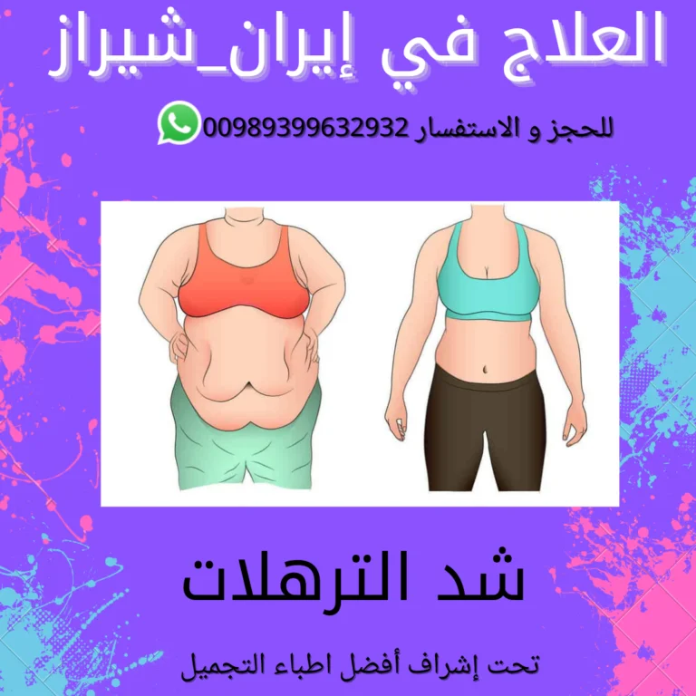عملية شفط الدهون في ايران
