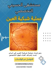 عملية شبكية العين في ايران