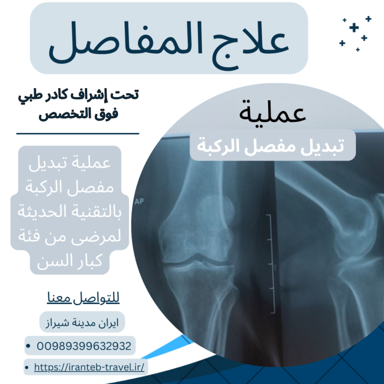 تكلفة عملية الركبة في ايران