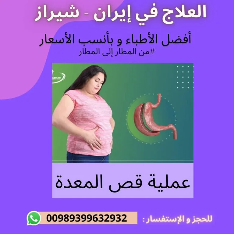 تكلفة عملية تكميم المعدة في ايران