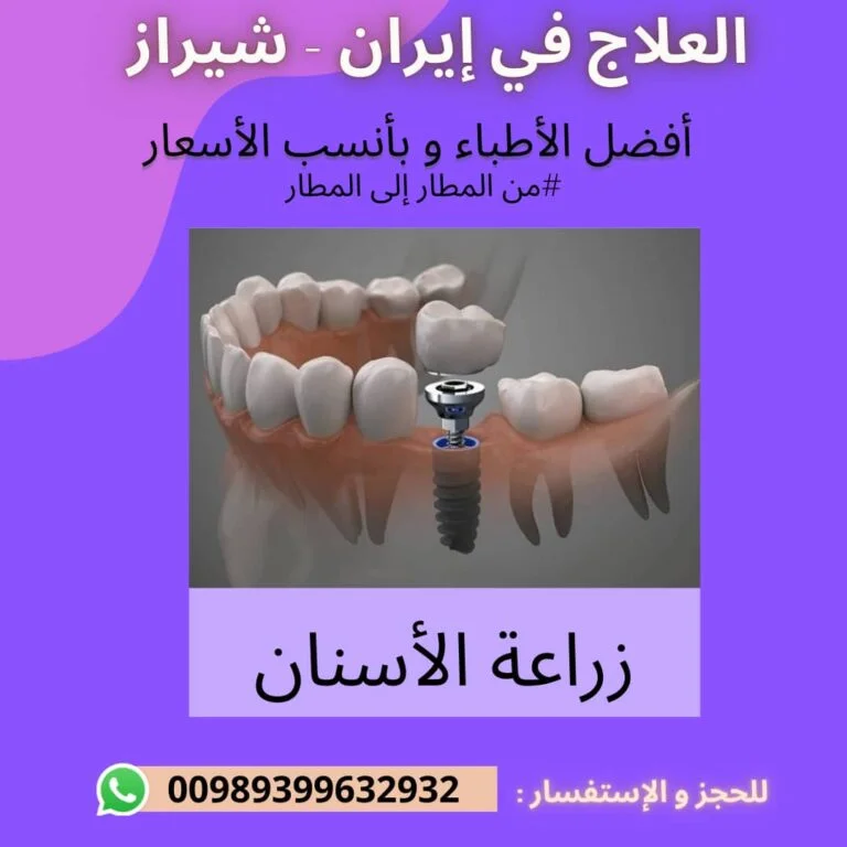 زراعة الأسنان في ايران
