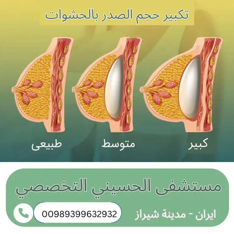 تكبير الصدر في ايران بالسيلكون