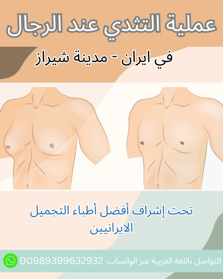 عملية التثدي في ايران