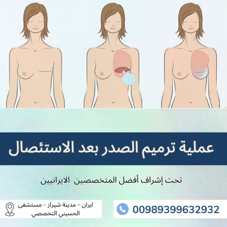 عملية الصدر في ايران