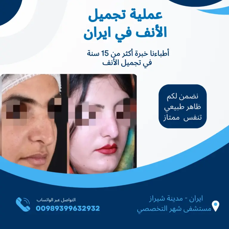 افضل-دكتور-تجميل-انف-في-ايران-