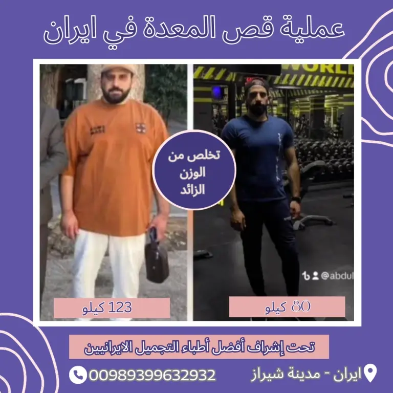 افضل طبيب تجميل في ايران