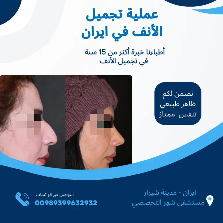 تجميل-الأنف-في-ايران