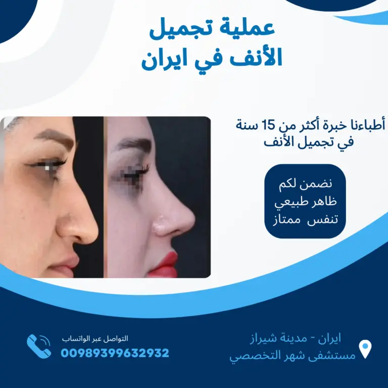 تجميل-الانف-في-ايران