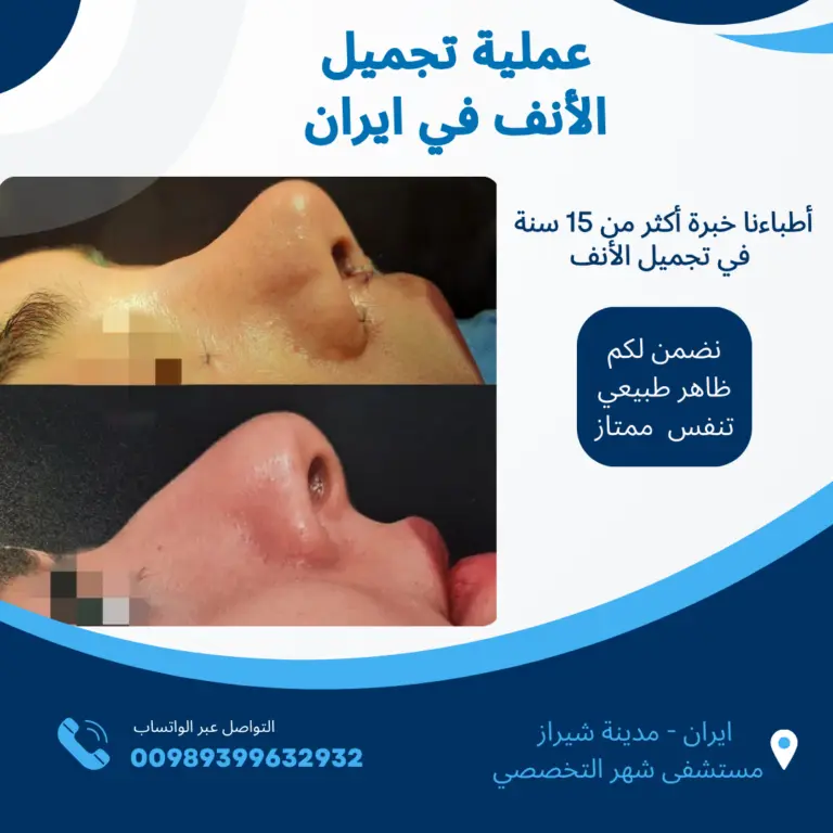 تكاليف-تجميل-الانف-في-ايران