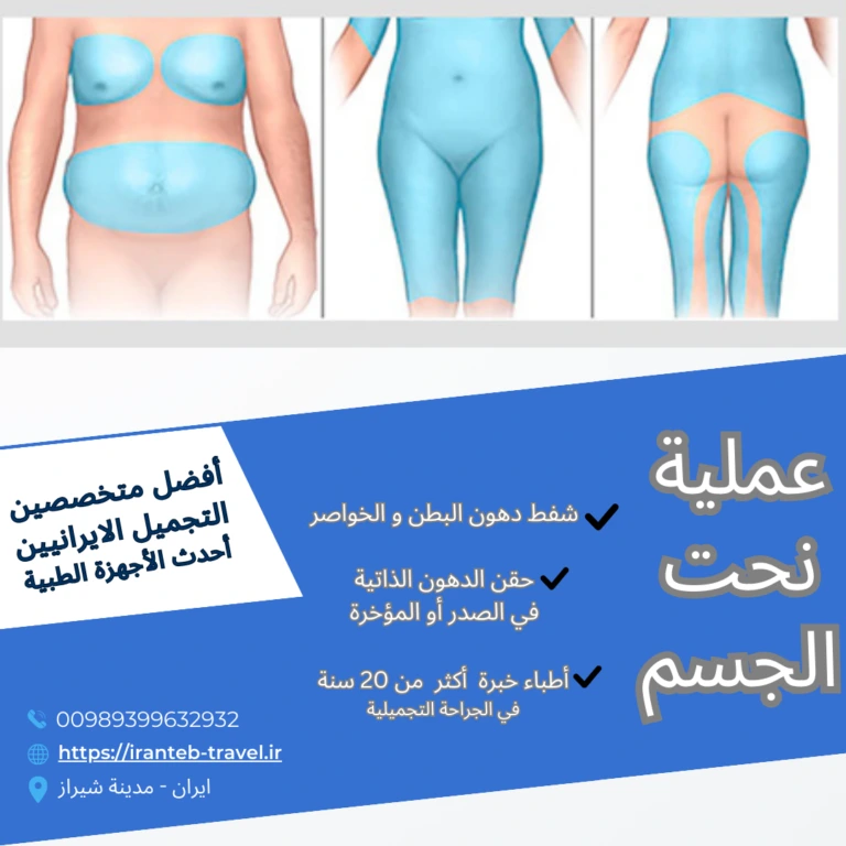 شفط الدهون في ايران شيراز