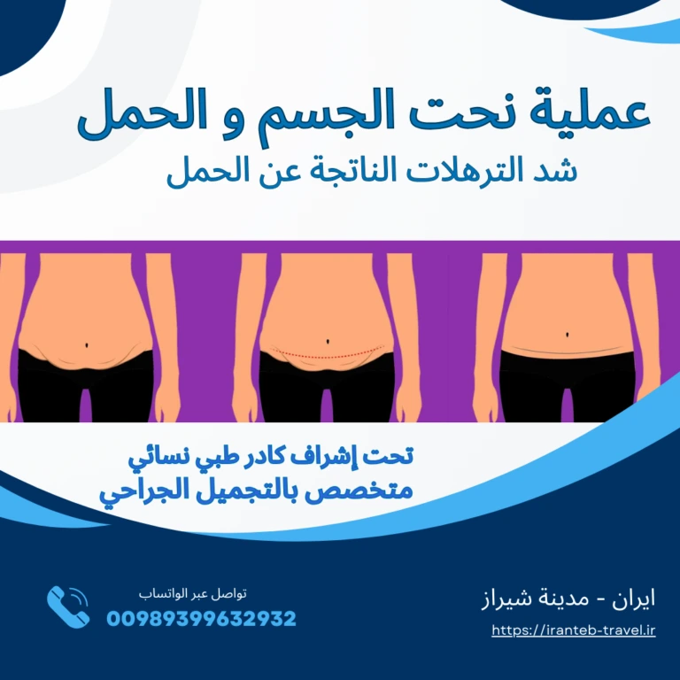 شفط الدهون في ايران