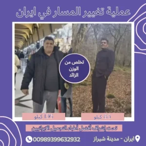 عملية تكميم المعدة في ايران