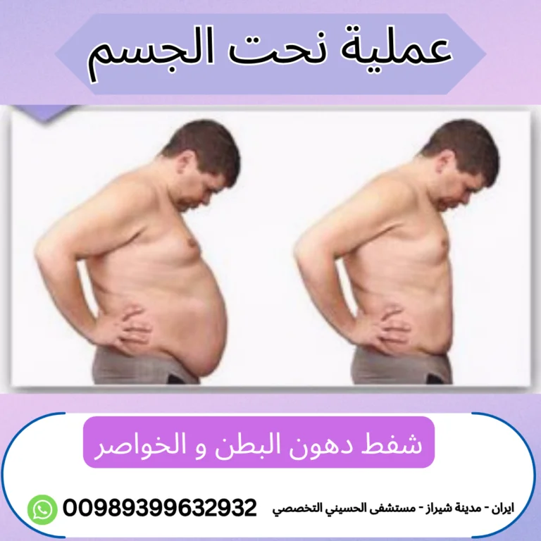 عملية نحت الجسم في شيراز