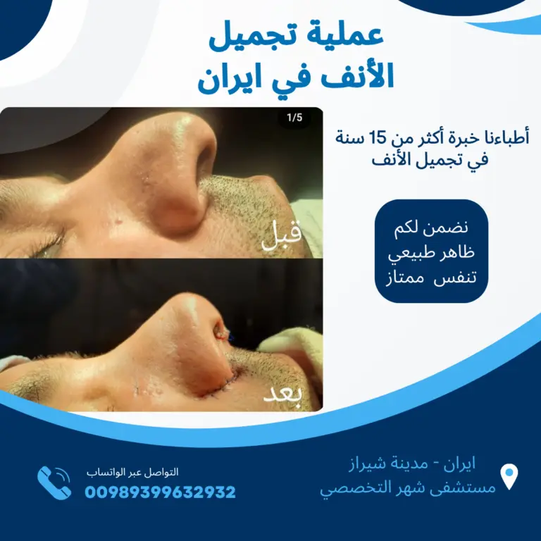 عملية تجميل الانف في ايران
