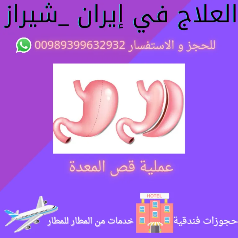 عملية قص المعدة في ايران