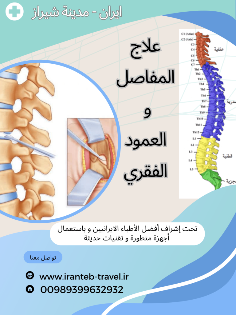 علاج الانزلاق الغضروفي و الديسك في ايران