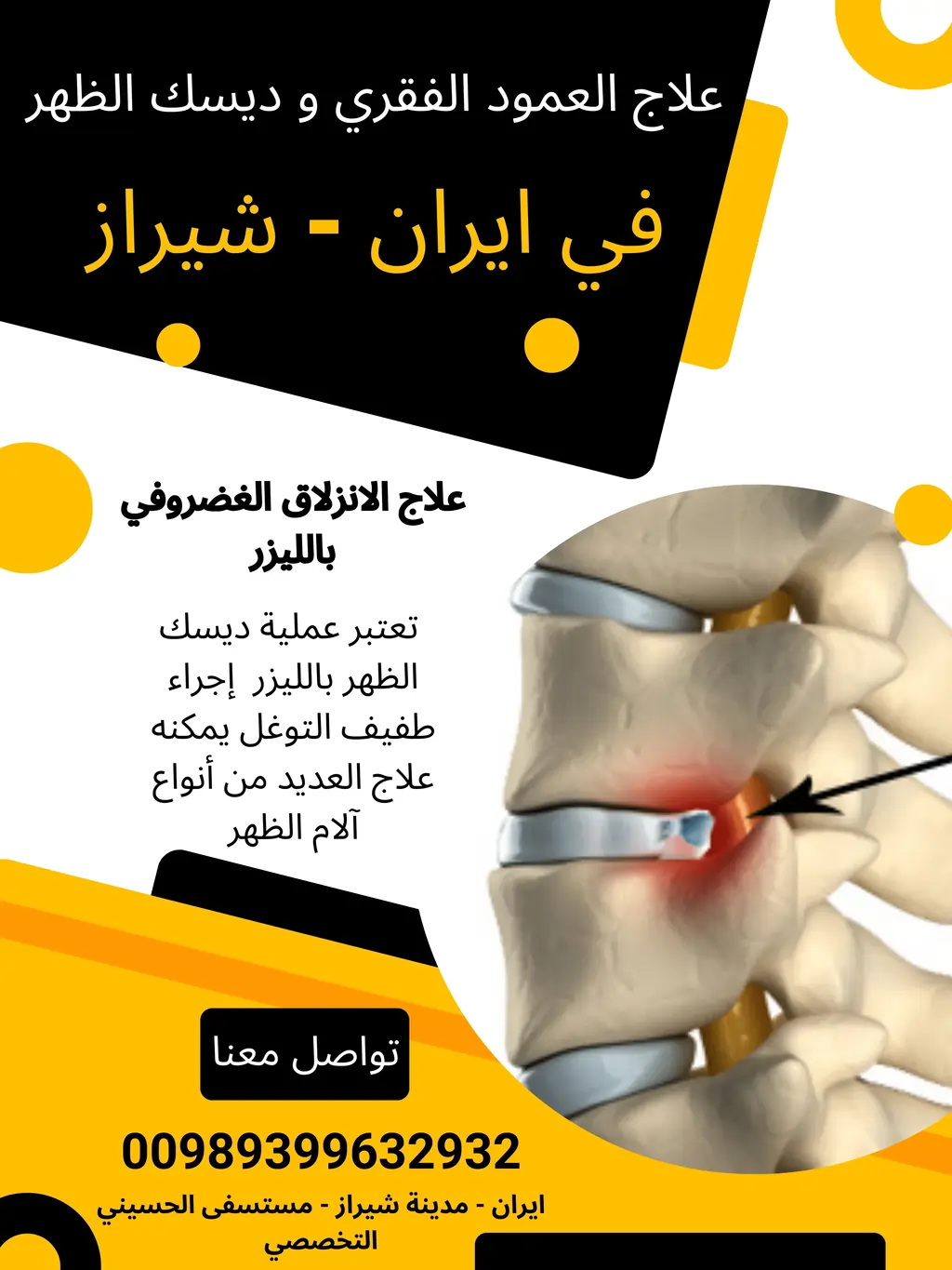 علاج العمود الفقري في ايران