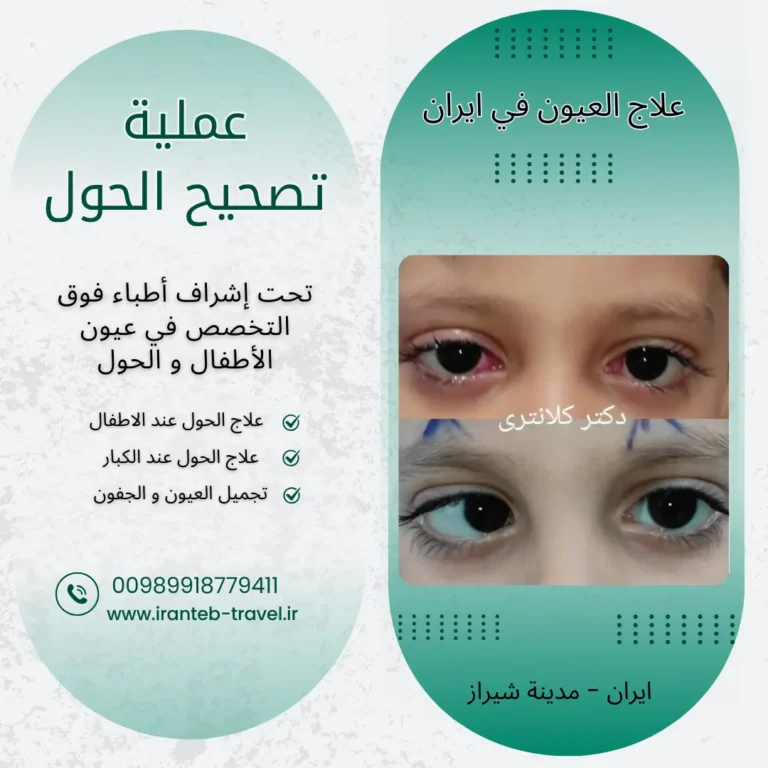 علاج حول العيون في ايران شيراز