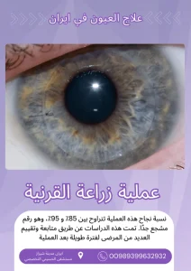 عملية زراعة القرنية في ايران