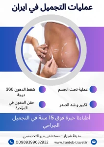 عملية نحت الجسم في ايران