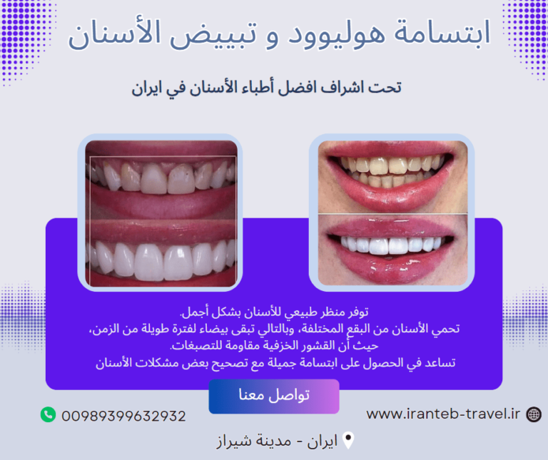 ابتسامة هوليوود في ايران