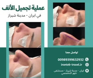 تجميل-الانف-في-ايران