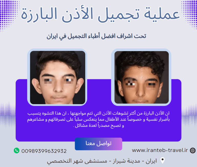 عملية تجميل الأذن في ايران