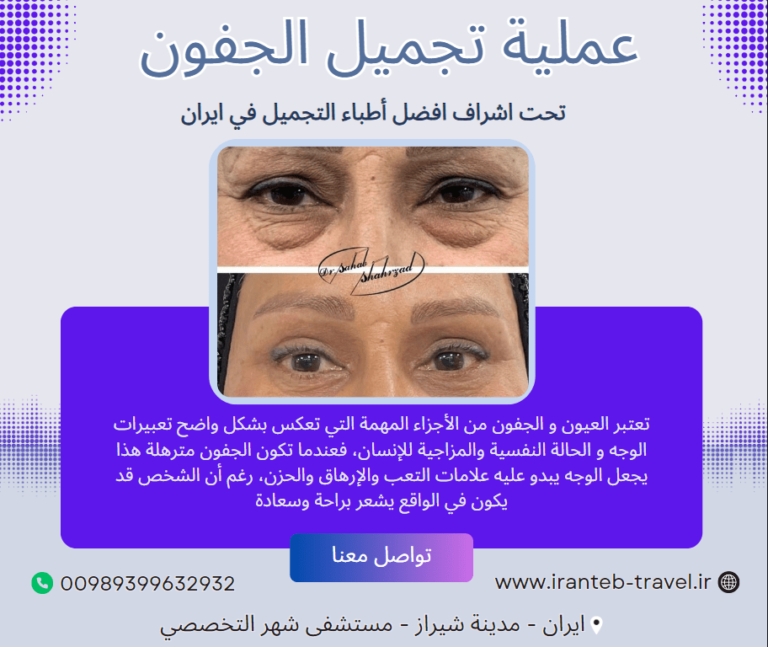 عملية تجميل الجفون في ايران