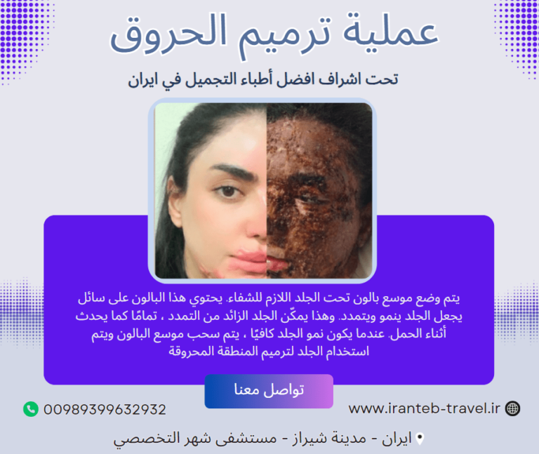 عملية ترميم الحروق في ايران