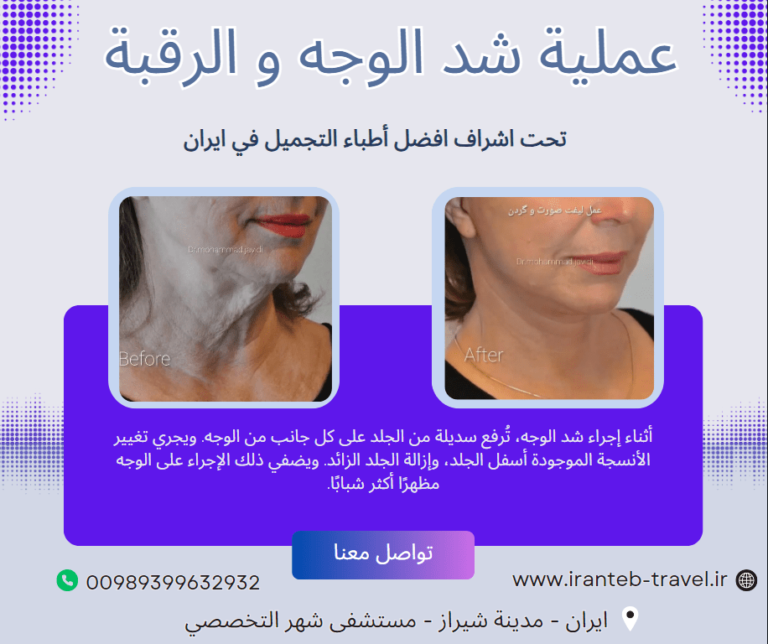 عملية شد الوجه في ايران