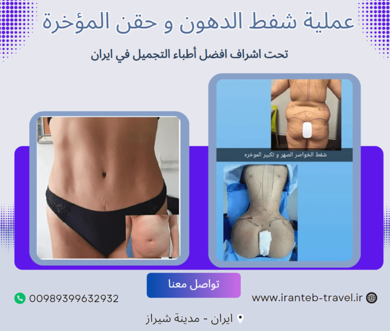 عملية شفط الدهون في ايران