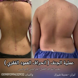 عملية الجنف في ايران