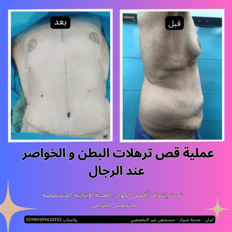 افضل دكتور تجميل في ايران
