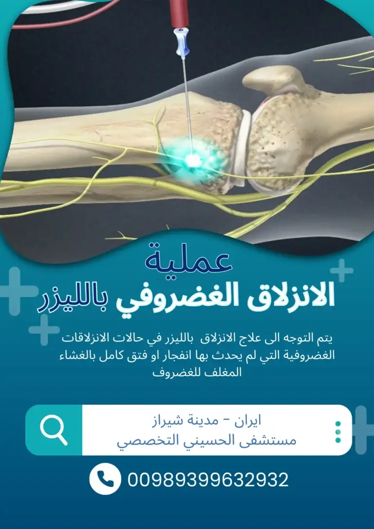 علاج الفقرات بالليزر في ايران