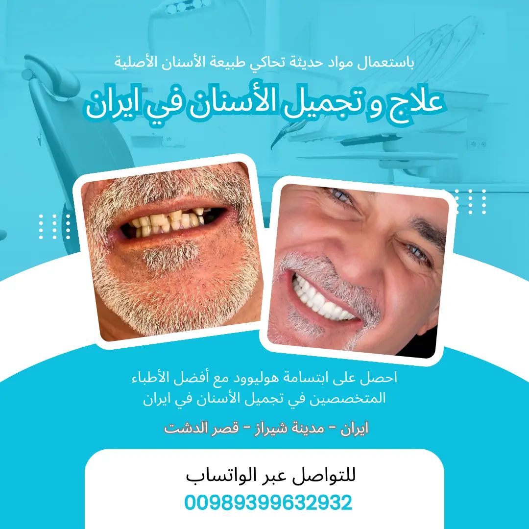 أفضل عيادات الاسنان في ايران