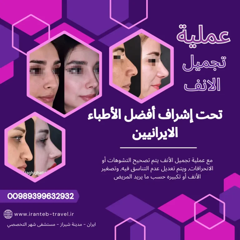 افضل دكتور تجميل في ايران