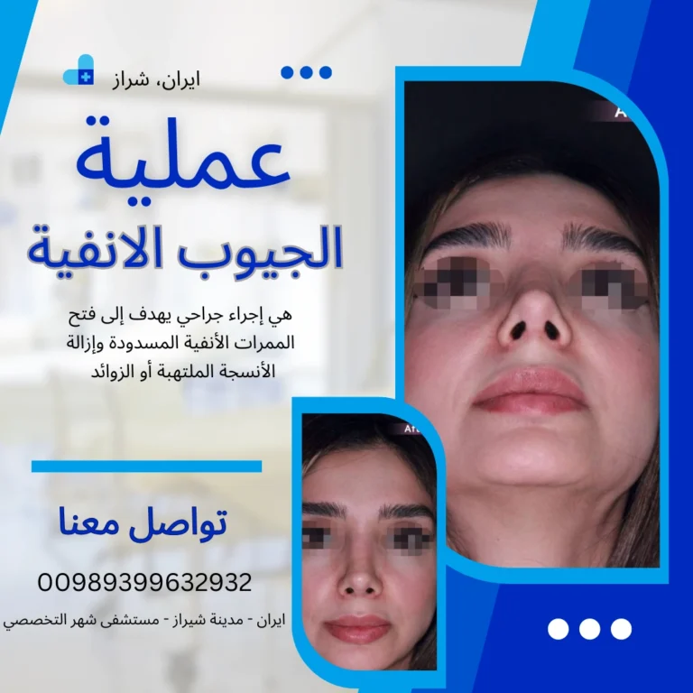 عملية انحراف الانف في ايران