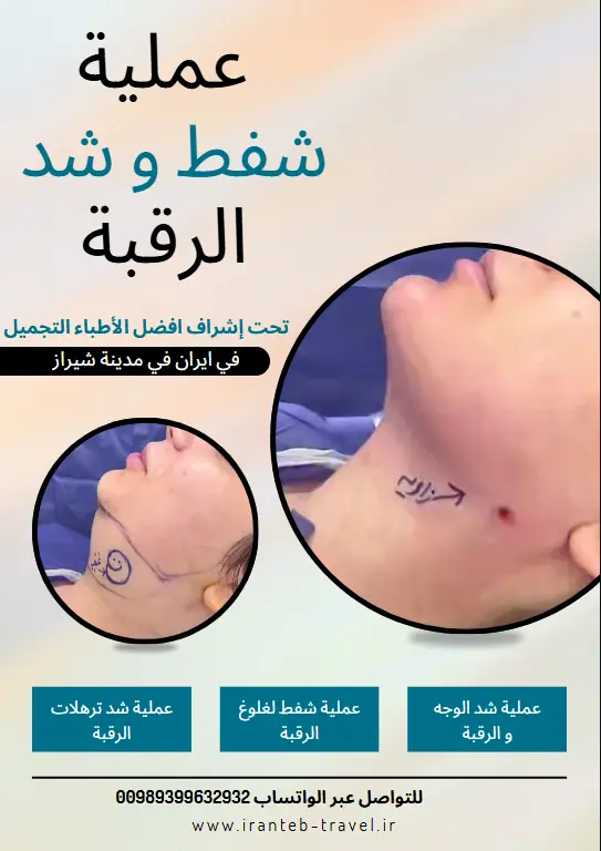 عملية لغلوغ الرقبة في ايران