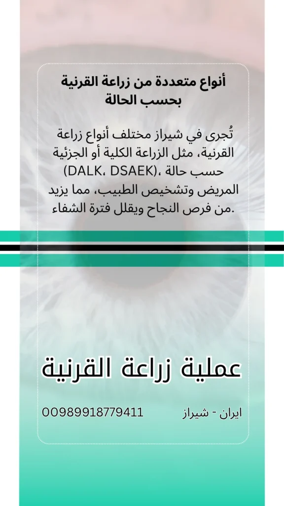 زراعة القرنية في ايران شيراز