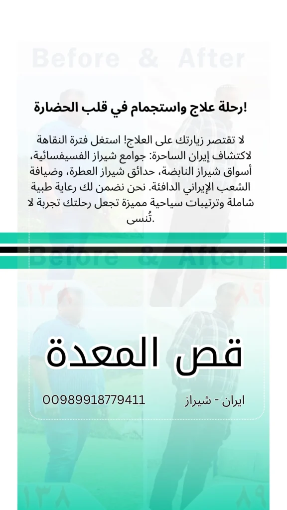 عملية قص المعدة في ايران شيراز