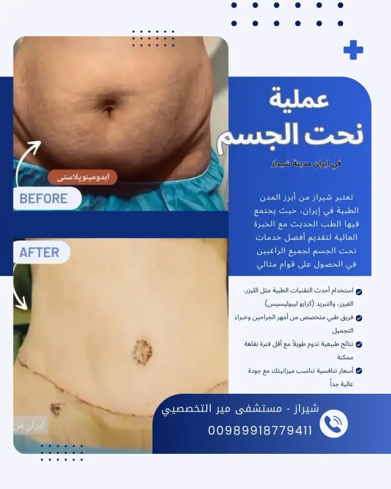 أفضل أطباء التجميل في ايران