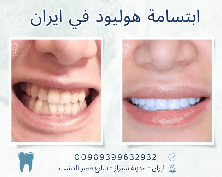 ابتسامة هوليود في ايران