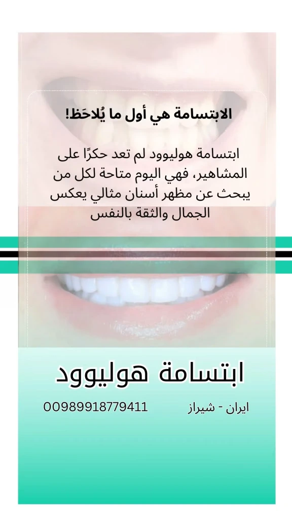 ابتسامة-هوليود-في-ايران-شيراز