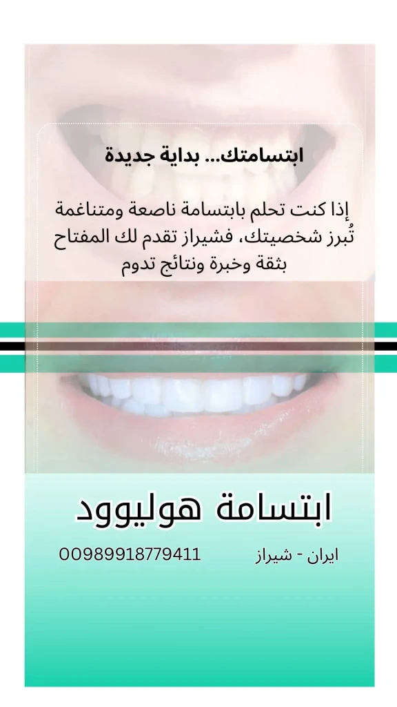 ابتسامة-هولييود-في-ايران