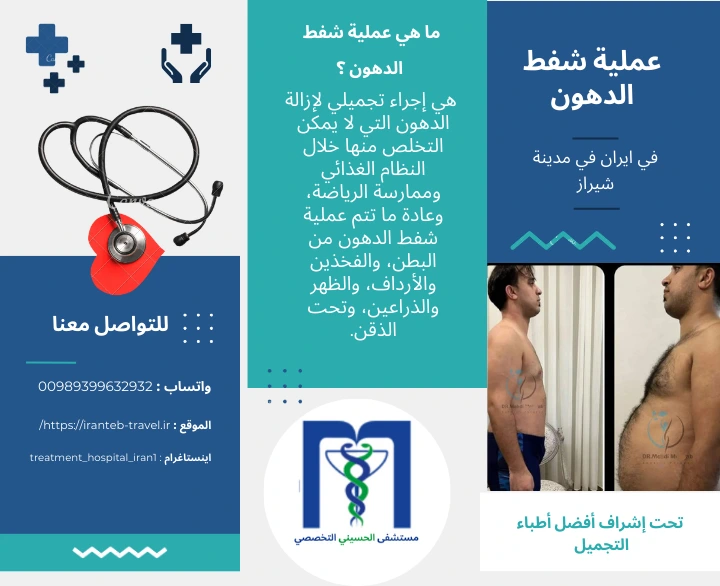 افضل-دكتور-شفط-الدهون-في-ايران