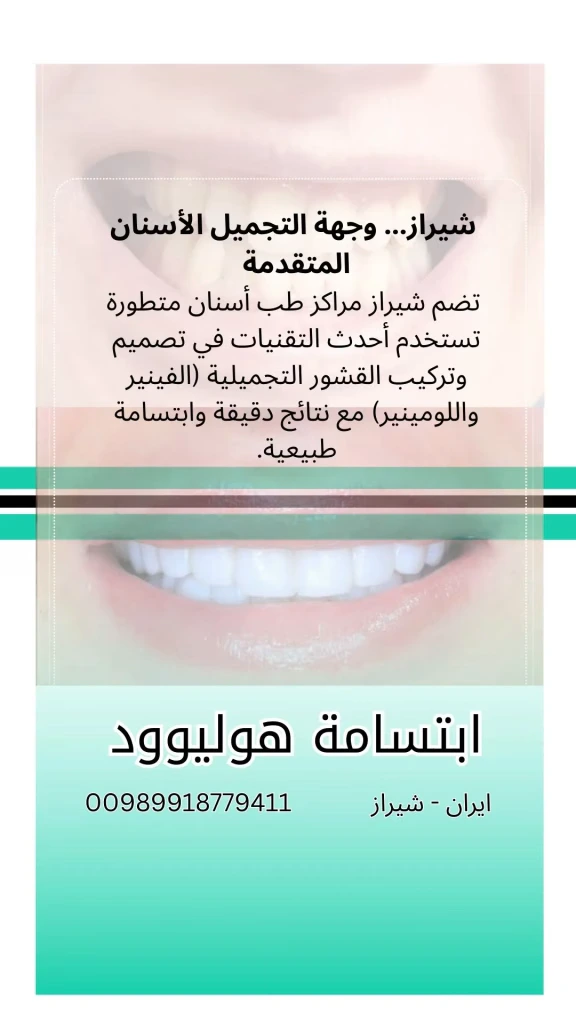 تكلفة-ابتسامة-هوليود-في-ايران
